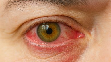 همه چیز درباره قطره چشمی لاکروسپورین